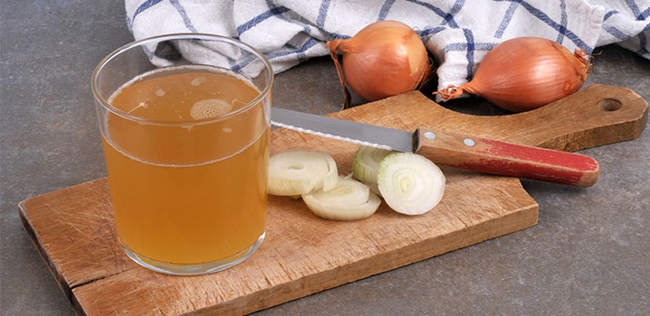 Küchenbrett mit Messer, Zwiebeln und einem Glas Zwiebelsaft